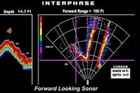      Interphase iScan 180 TH